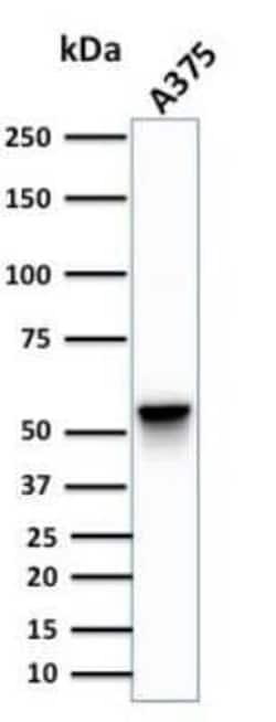 Vimentin Antibody (SPM576) - Azide and BSA Free, Novus Biologicals 0.1 mg | Buy Online | Novus Biologicals | Fisher Scientific