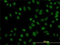 ZNF143 Antibody (2B4), Novus Biologicals 0.1 mg | Buy Online | Novus Biologicals | Fisher Scientific
