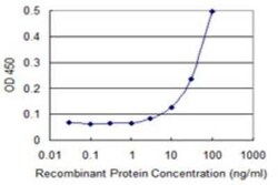 ZNF167 Antibody (3A12), Novus Biologicals 0.1 mg | Buy Online | Novus Biologicals | Fisher Scientific