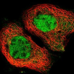 Abcam Anti-YTHDC1 antibody, 100 uL