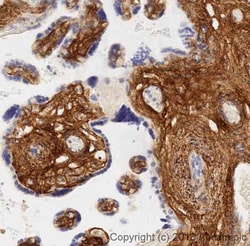 Abcam Anti-Collagen I antibody [EPR7785], 100 uL
