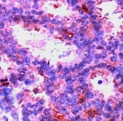 Anti-ERK2 antibody, Abcam