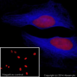 Goat Anti-Rabbit IgG H&L (Alexa Fluor&trade; 405) preadsorbed, Abcam