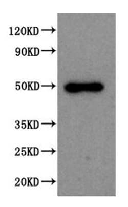 Anti-SPOCK1 antibody, Abcam
