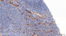 Anti-CD31 antibody, Abcam
