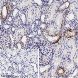 Anti-NCX1 antibody [C2C12], Abcam