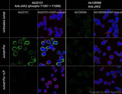 Anti-JAK2 (phospho Y1007 + Y1008) + JAK1 (phospho Y1034 + Y1035) antibody [E132], Abcam