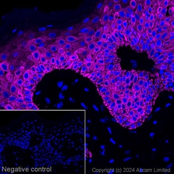 Alexa Fluor&trade; 647 Anti-Cytokeratin 14 antibody [LL002], Abcam