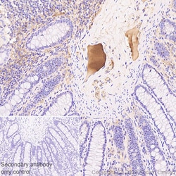 Anti-Prothrombin antibody [RM1252], Abcam