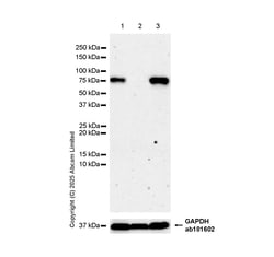 Anti-MARCO antibody [RM1219], Abcam
