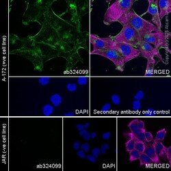 Anti-OSMR antibody [RM2085], Abcam