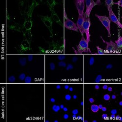 Anti-OSMR antibody [RM1322], Abcam