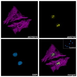 Alpaca monoclonal [3G2] Anti-Chicken IgY antibody (Alexa Fluor&trade; 647), Abcam
