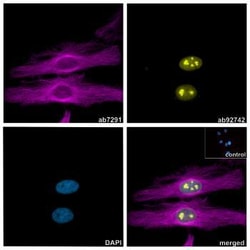 Alpaca monoclonal [10A4] Anti-Mouse IgG1 antibody (Alexa Fluor&trade; 647), Abcam