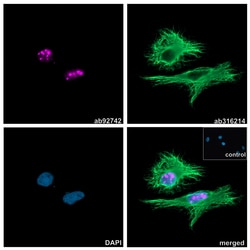 Alpaca monoclonal [10E10] Anti-Rabbit IgG antibody (Alexa Fluor&trade; 647), Abcam