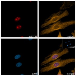 Alpaca multiclonal [10E10 / 8C10] Anti-Rabbit IgG antibody (AZdye 568), Abcam