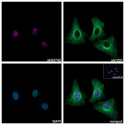 Alpaca multiclonal [10E10 / 8C10] Anti-Rabbit IgG antibody (Alexa Fluor&trade; 647), Abcam