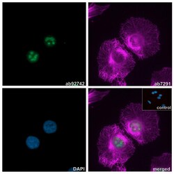 Alpaca multiclonal [10E10 / 8C10] Anti-Rabbit IgG antibody (ATTO 488), Abcam