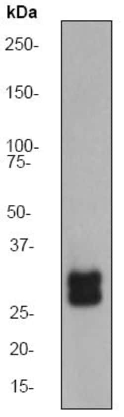 Anti-TGIF antibody [EP637Y], Abcam