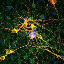 Abcam Anti-MAP2 antibody - Neuronal Marker, 25 uL