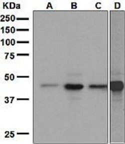 Anti-BRN3A antibody [EP1972Y], Abcam