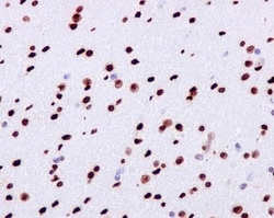Abcam Anti-gamma H2A.X (phospho S139) antibody [EP854(2)Y], 100 uL