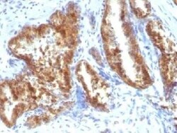 alpha-Methylacyl-CoA Racemase/AMACR Antibody - Azide and BSA Free, Novus Biologicals 0.1 mg | Buy Online | Novus Biologicals | Fisher Scientific