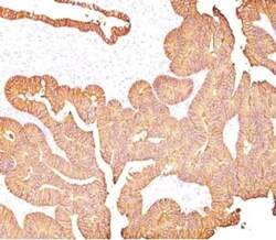 EpCAM/TROP1 Antibody (323/A3) - (ECD) - Azide and BSA Free, Novus Biologicals