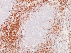 CD5 Antibody (C5/473 + CD5/54/F6) - Azide and BSA Free, Novus Biologicals
