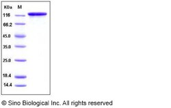 Sino Biological Human EGFR / HER1 / ErbB1 Protein (Fc Tag) 100ug, Quantity: