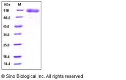 Sino Biological Recombinant Human EGFR Protein (ECD, His Tag), HPLC-verified,