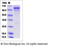 Sino Biological Human EGFR / HER1 / ErbB1 (aa 668-1210) Protein (His &