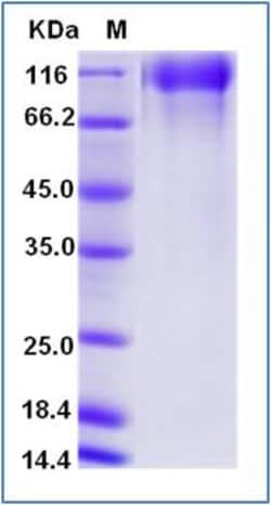 Sino Biological Recombinant Human EGFR Protein (ECD, His & AVI Tag), Biotinylated,