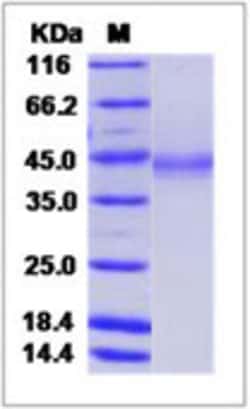 Sino Biological Bovine TMPRSS15 Protein 50ug (Sino Biological), Quantity: