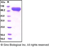 Sino Biological Influenza A H5N1 (A/VietNam/1203/2004) Hemagglutinin Protein
