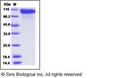 Sino Biological Human HER2 / ErbB2 Protein (ECD, His Tag), Biotinylated