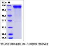 Sino Biological Recombinant Human Her2/ERBB2 Protein (ECD), Biotinylated,