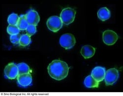 Sino Biological Recombinant Anti-Her2/ERBB2 Antibody, Rabbit Monoclonal,