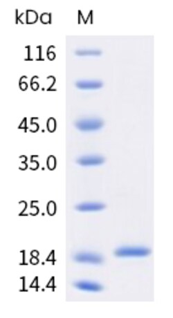Sino Biological Human G-CSF / CSF3 Protein (Isoform b) 100ug, Quantity: