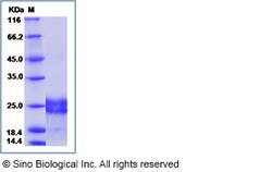 Sino Biological VEGF183 Protein, Human, Recombinant, Quantity: Each of