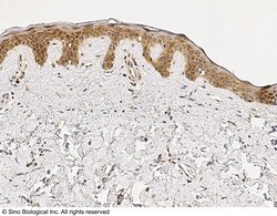 Sino Biological IL-1RA / IL1RN Antibody, Rabbit MAb 100uL, Quantity: Each