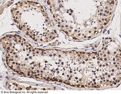 Sino Biological Recombinant Anti-SOX2 Antibody, Rabbit Monoclonal, Quantity: