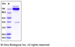 Sino Biological Recombinant Human Neuropilin-1/NRP1 Protein (ECD, V179A,