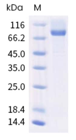 Sino Biological Human NRP1 Protein 1MG (Sino Biological), Quantity: Each