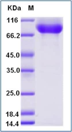 Sino Biological Human Neuropilin-1 / NRP1 / CD304 Protein (His & AVI Tag),