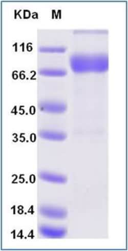 Sino Biological Human VEGFR2 / Flk-1 / CD309 / KDR Protein (Domain 1&2&3,