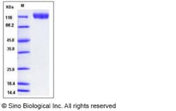 Sino Biological Recombinant Human VEGFR2/KDR Protein (His Tag), Amine-Labeled