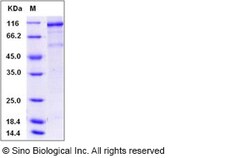 Sino Biological Human VEGFR2 / Flk-1 / CD309 / KDR Protein (His & GST Tag)