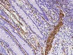 Sino Biological Anti-ACTA2 Antibody, Rabbit Polyclonal, Quantity: Each