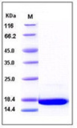 Sino Biological Recombinant Human FGF1 Protein, Quantity: Each of 1